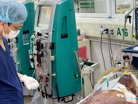 Sau sốt vài giờ, người đàn ông nổi tím khắp người, sốc vì nhiễm liên cầu lợn