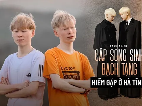 Cuộc sống kỳ lạ của cặp song sinh Hà Tĩnh có ngoại hình khác biệt