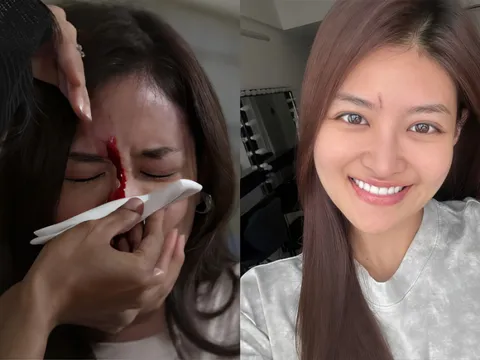 Nữ diễn viên Việt bị đoàn phim kiện đòi bồi thường 20 tỷ đồng