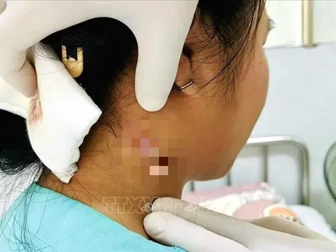 Đồng Nai ghi nhận ca bệnh từ vi khuẩn Whitmore đầu tiên
