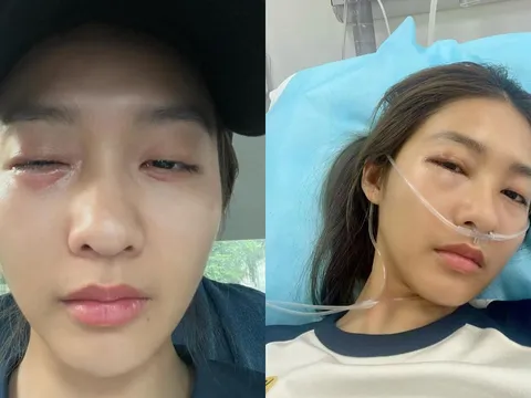 Khả Ngân nhập viện, mặt sưng vù gây lo lắng