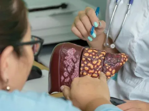 Dấu hiệu nhận biết viêm gan C
