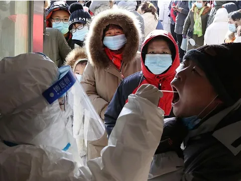 Trung Quốc phát hiện virus mới gây bệnh và lây nhiễm trên người