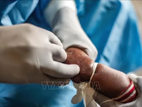 WHO duy trì tình trạng khẩn cấp y tế toàn cầu đối với bệnh đậu mùa khỉ