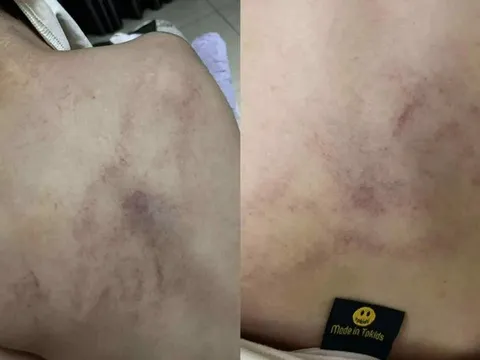Giáo viên mầm non bạo hành bé gái 4 tuổi, Ban Giám hiệu 'sốc' khi xem lại camera