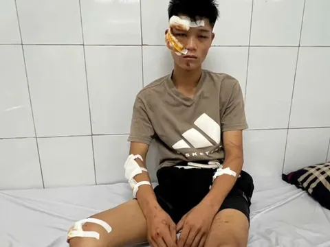 Lời khai gây phẫn nộ của quái xế thông chốt tông một Đại uý chấn thương nặng