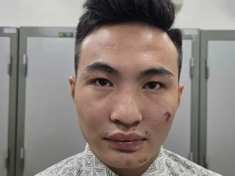 Tạm giữ hình sự Nguyễn Xuân Khải - kẻ lao xe máy vào cán bộ Công an bảo vệ A80