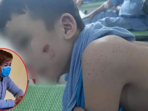 Đề nghị xử lý nghiêm chủ quán bạo hành trẻ em ở Bắc Ninh