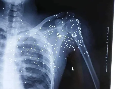 Thái Bình: Nghi phạm vụ nổ súng ở trạm thu phí BOT Thanh Nê ra đầu thú