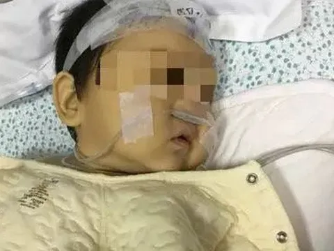 Đứa trẻ 2 tháng tuổi toàn thân tím tái, co giật, hôn mê vì hành động xuất phát từ sự lo lắng quá mức của người mẹ