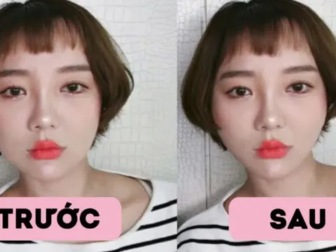 Nhiều người sử dụng miếng dán thon gọn mặt để mặt nhỏ xinh nhưng sự thật có thể khiến bạn đau lòng