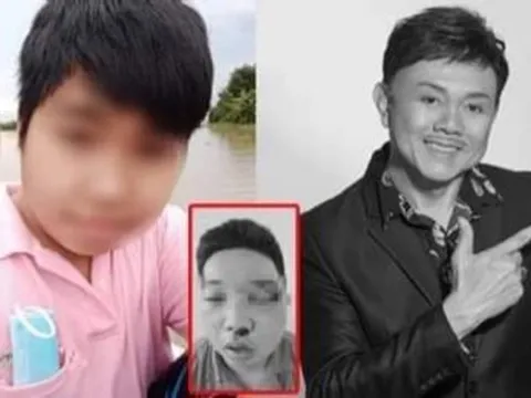 Dân mạng xôn xao trước hình ảnh thanh niên xúc phạm cố NS Chí Tài sưng húp mặt mũi, nghi bị đánh