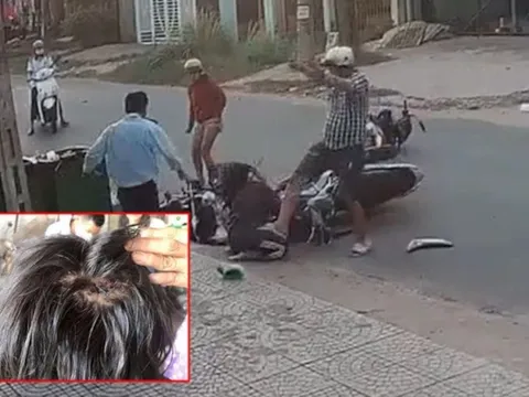 Nữ sinh bị đánh dã man sau va chạm giao thông: Phải khâu 10 mũi trên đầu, tạm thời nghỉ học