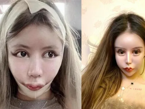 'Hotgirl thẩm mỹ' trải lòng chuyện dao kéo hơn 100 lần của bản thân khiến nhiều người bàng hoàng