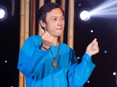 Hoài Linh tiết lộ đã đi gặp bác sĩ, muốn thẩm mỹ để níu giữ tuổi xuân