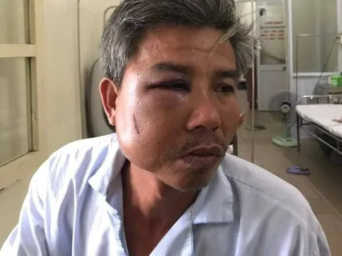 Chụp hình ghi nhận hiện trạng, nhân viên cây xanh bị đánh phải nhập viện