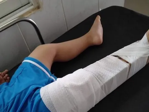 Tạm đình chỉ cô giáo mầm non làm bé 3 tuổi gãy xương đùi trong lớp