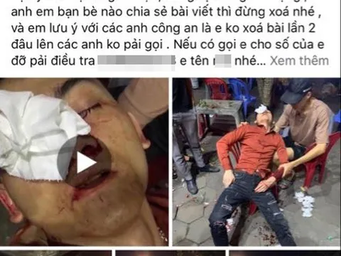 CSGT ở Vĩnh Phúc bị tố dùng dùi cui vụt vỡ mũi người vi phạm giao thông