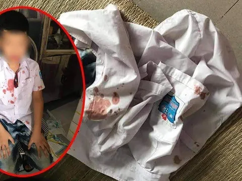 Phụ huynh vào trường đưa bé trai lớp 1 ra ngoài hành hung để giải quyết mâu thuẫn cho con