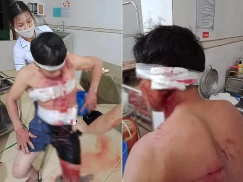 Điều tra vụ nhóm đối tượng xông vào nhà đánh người trọng thương