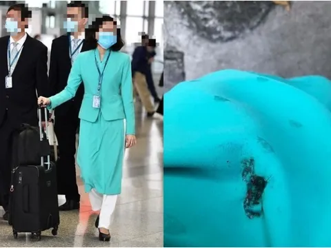 Xôn xao hình ảnh TVHK Vietnam Airlines bị dí thuốc lá cháy dở vào bả vai khi đang mặc đồng phục