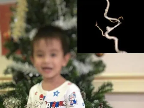 Cứu sống thành công bé trai 3 tuổi bị đột quỵ trong lúc đang chơi với bạn