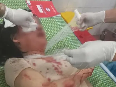 Bị 3 đối tượng cướp giật, thiếu nữ bị kéo lê gần 30m