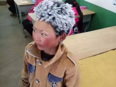 Cuộc sống của 'cậu bé băng tuyết' từng gây sốt mạng xã hội bây giờ ra sao?