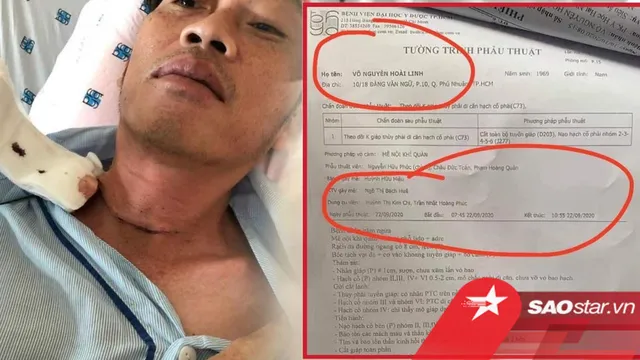 Lộ bản tường trình phẫu thuật của Hoài Linh: Thời gian sai lệch với thông tin công bố trước đó?