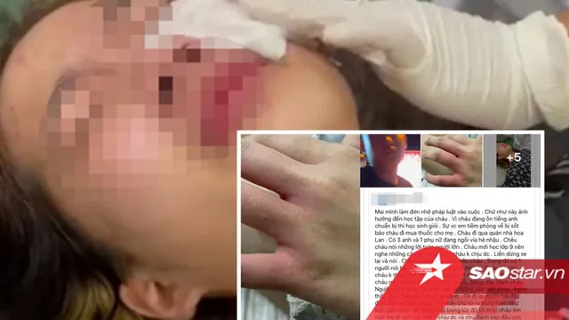Xót xa lời cầu cứu của người mẹ vụ nữ sinh bị nhóm nam thanh niên hành hung, xịt hơi cay vào mắt