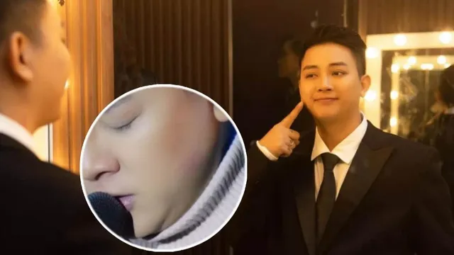 Hoài Lâm bị khán giả nữ hôn đỏ má, lên tiếng 'truy tìm' chủ nhân dấu son môi