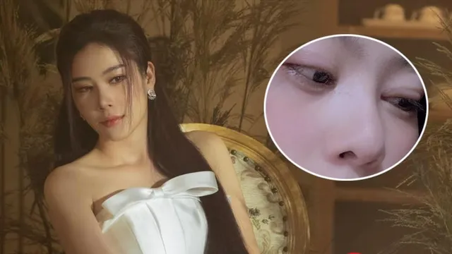 Nam Em gây lo lắng với gương mặt hốc hác, mắt sưng vù: Chuyện gì đang xảy ra?