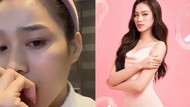Hoa hậu Đỗ Thị Hà vô tình tự tạo vết thương trên má, để lộ biểu cảm hoang mang
