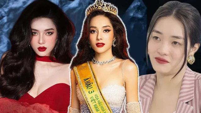 Á hậu 'đập mặt xây lại' công khai tiền sửa mũi, nghe xong ai cũng choáng!
