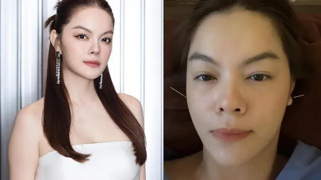 Phạm Quỳnh Anh gặp sự cố sức khoẻ, phải dùng kim châm để điều trị