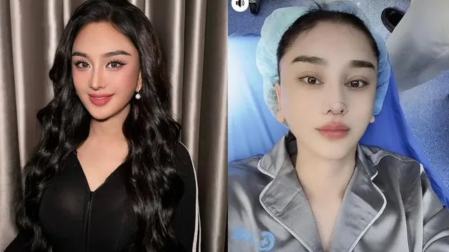 Hình ảnh mới nhất của Lâm Khánh Chi sau khi tiếp tục can thiệp 'dao kéo'